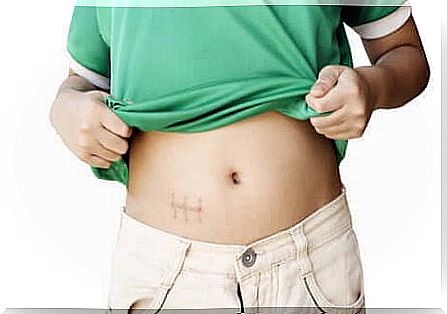 Appendicitis in teenagers